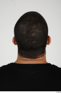 Photos of Luqmaan Saah hair head 0005.jpg